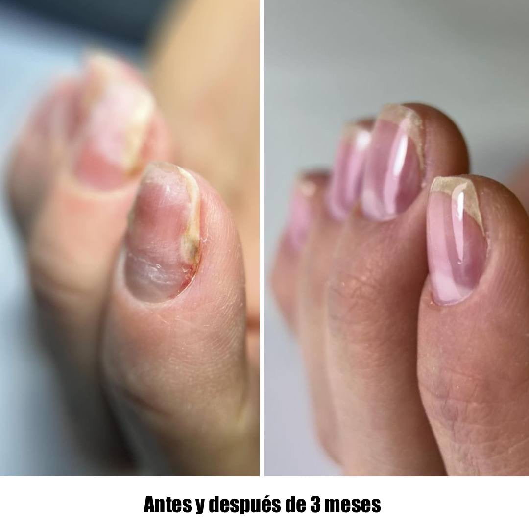 NAILSOFTHEDAY ONISTOP – Regenerating Oil, 15 ml