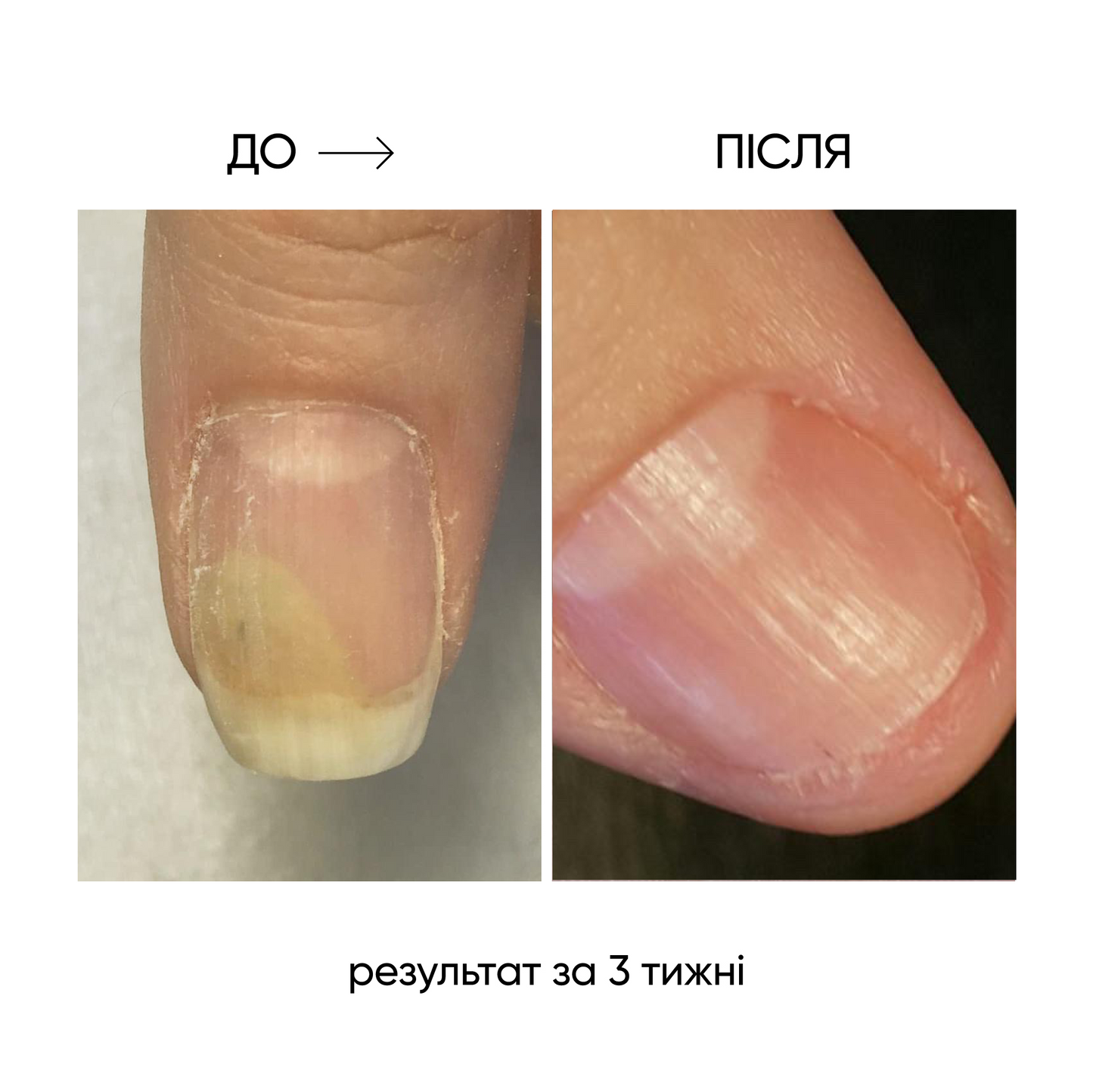 NAILSOFTHEDAY ONISTOP – Óleo regenerador, 15 ml
