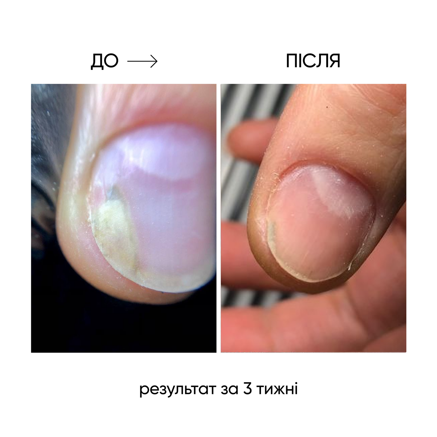 NAILSOFTHEDAY ONISTOP – Óleo regenerador, 15 ml