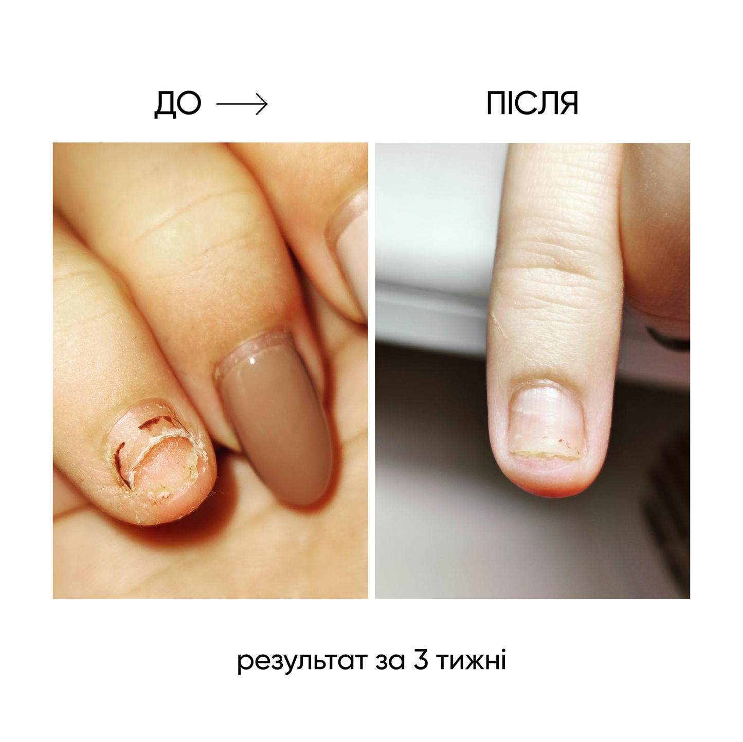 NAILSOFTHEDAY ONISTOP – Óleo regenerador, 15 ml