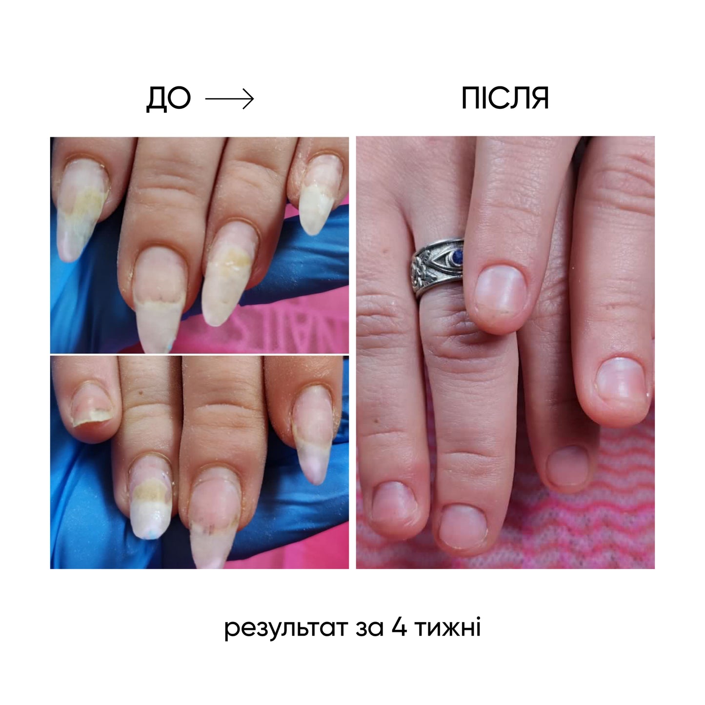 NAILSOFTHEDAY ONISTOP – Óleo regenerador, 15 ml