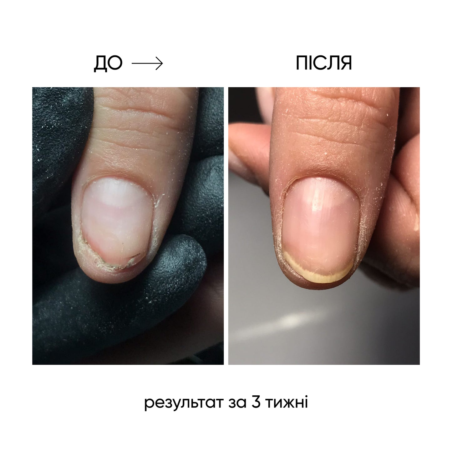 NAILSOFTHEDAY ONISTOP – Óleo regenerador, 15 ml