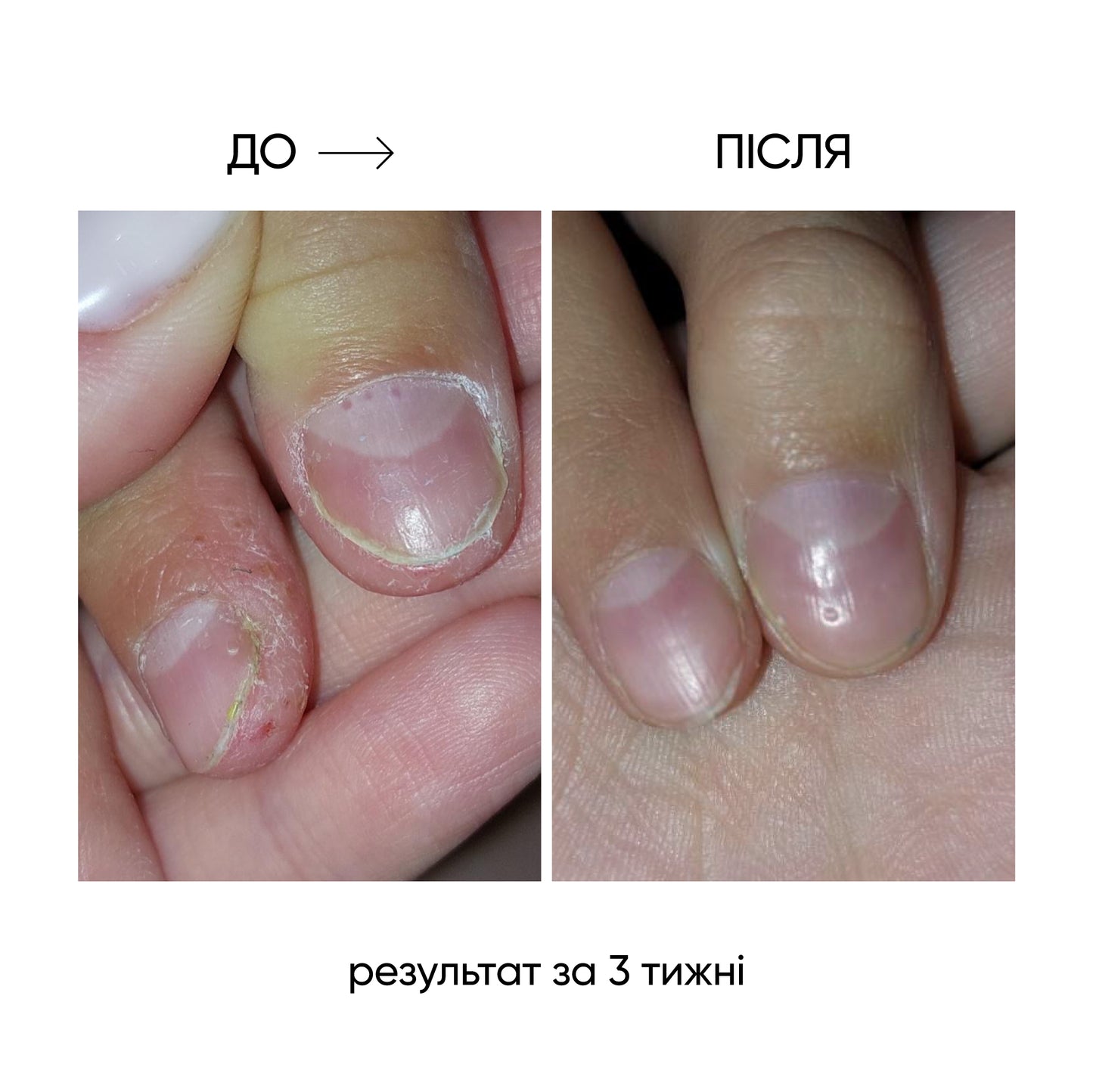 NAILSOFTHEDAY ONISTOP – Óleo regenerador, 15 ml