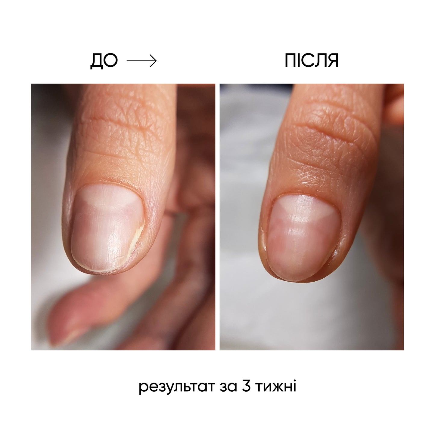 NAILSOFTHEDAY ONISTOP – Óleo regenerador, 15 ml