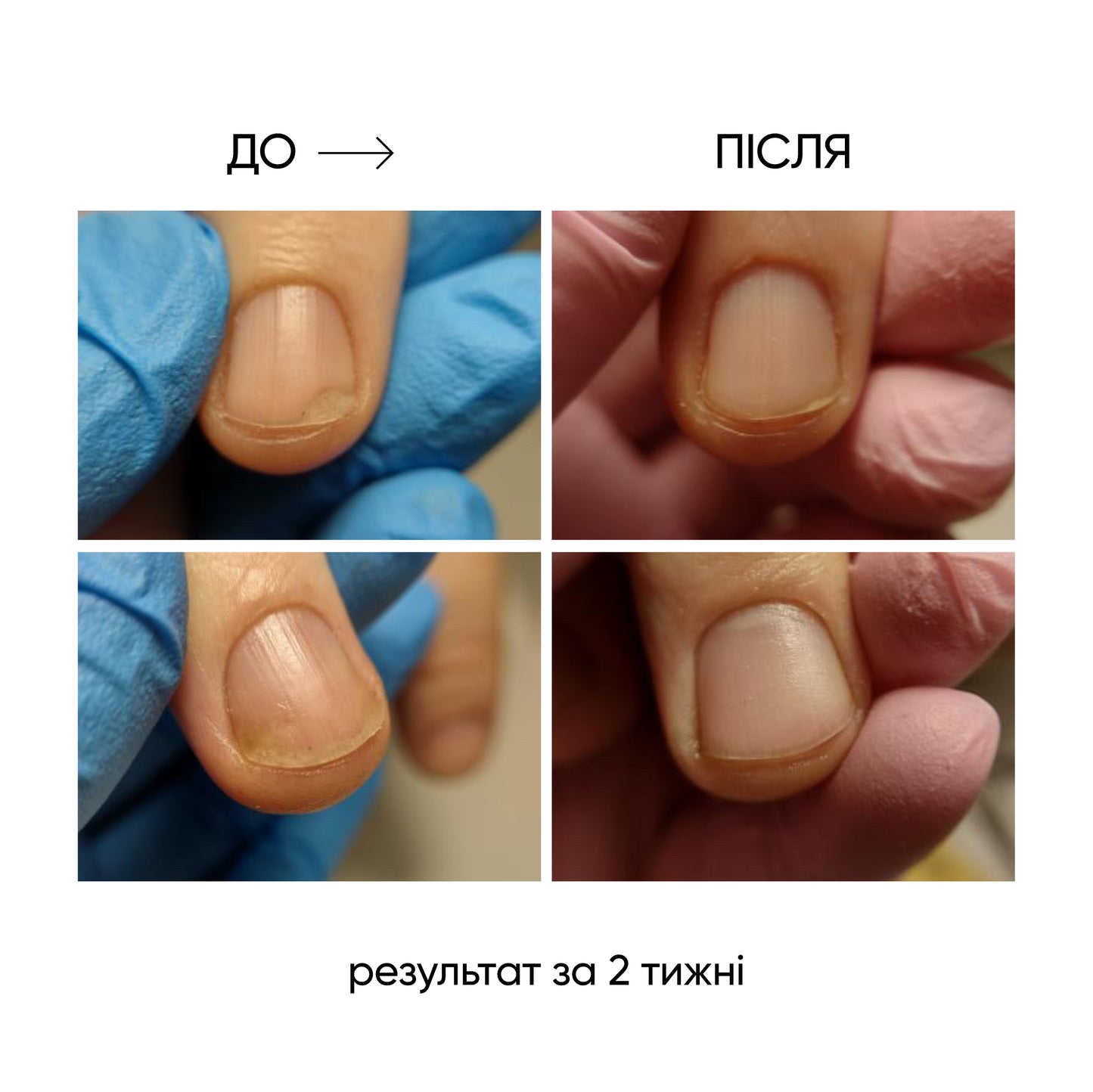 NAILSOFTHEDAY ONISTOP – Óleo regenerador, 15 ml