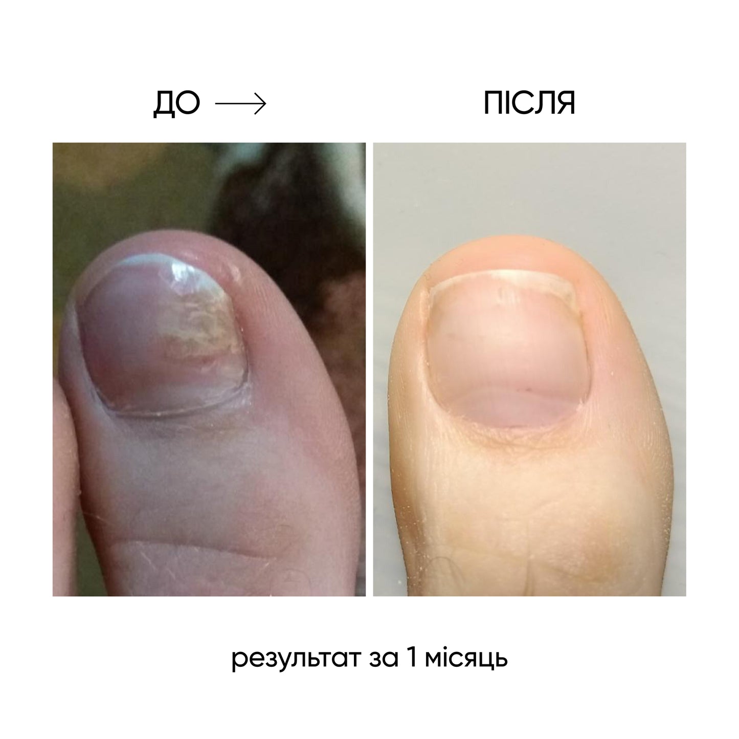 NAILSOFTHEDAY ONISTOP – Óleo regenerador, 15 ml