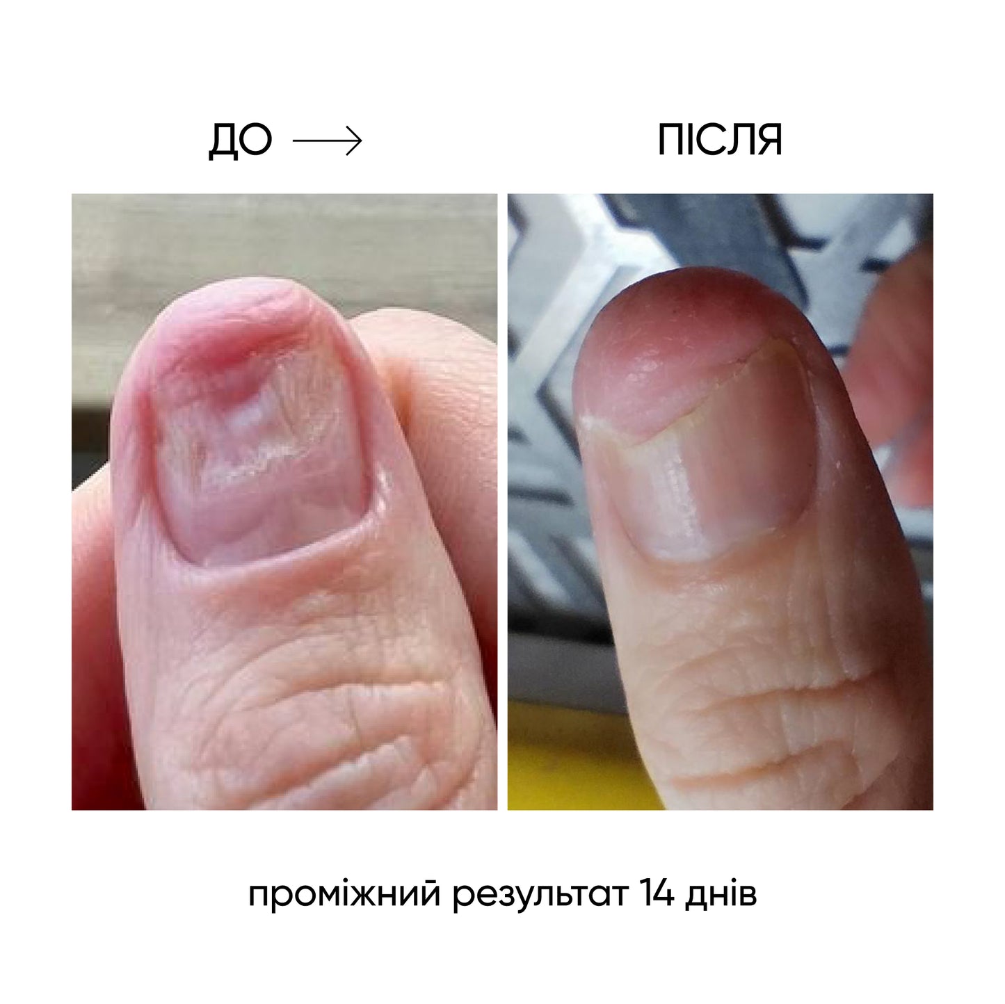 NAILSOFTHEDAY ONISTOP – Óleo regenerador, 15 ml