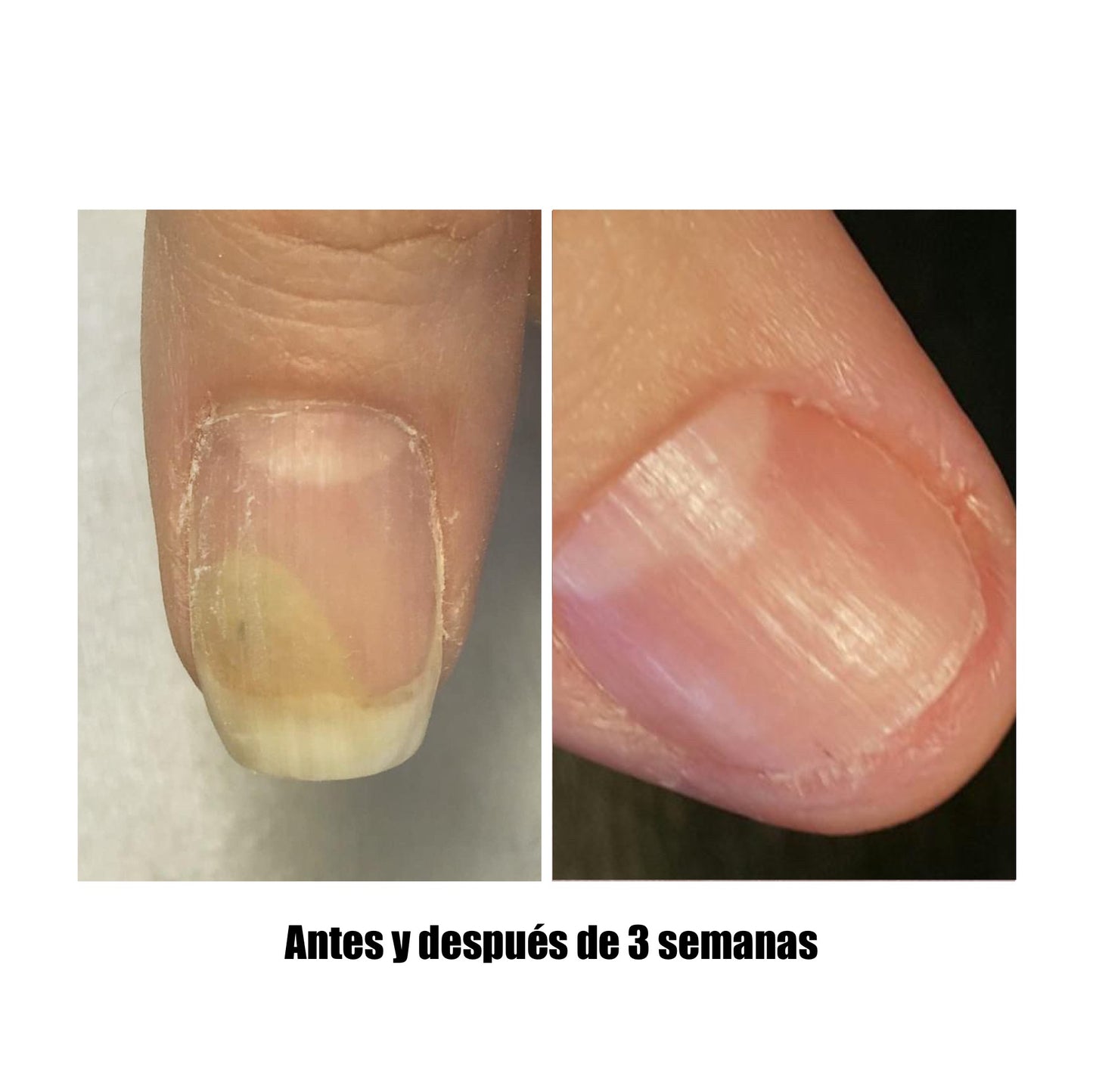 NAILSOFTHEDAY ONISTOP – Regenerating Oil, 15 ml