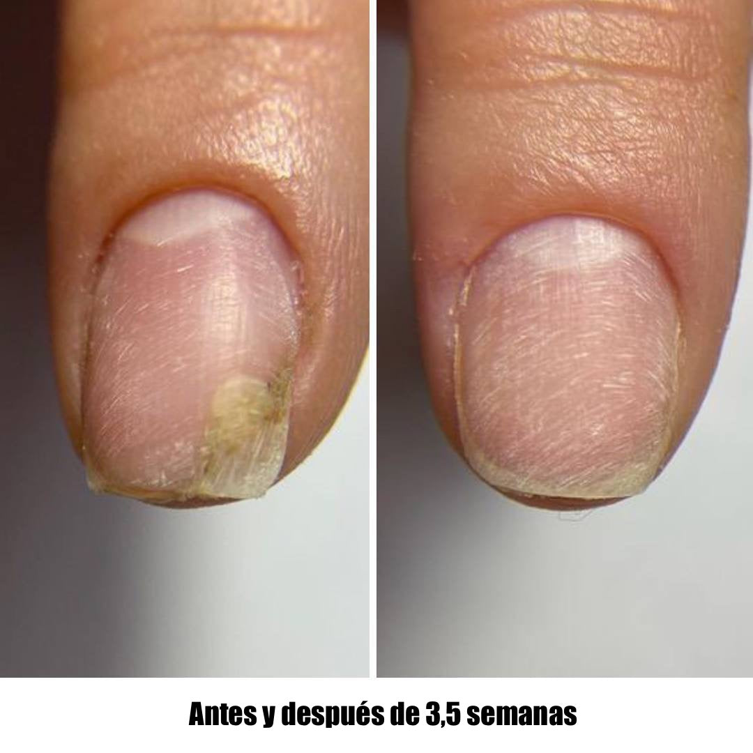 NAILSOFTHEDAY ONISTOP – Regenerating Oil, 15 ml