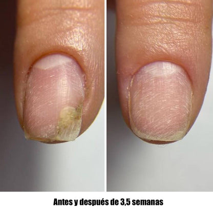 NAILSOFTHEDAY ONISTOP – Regenerating Oil, 15 ml