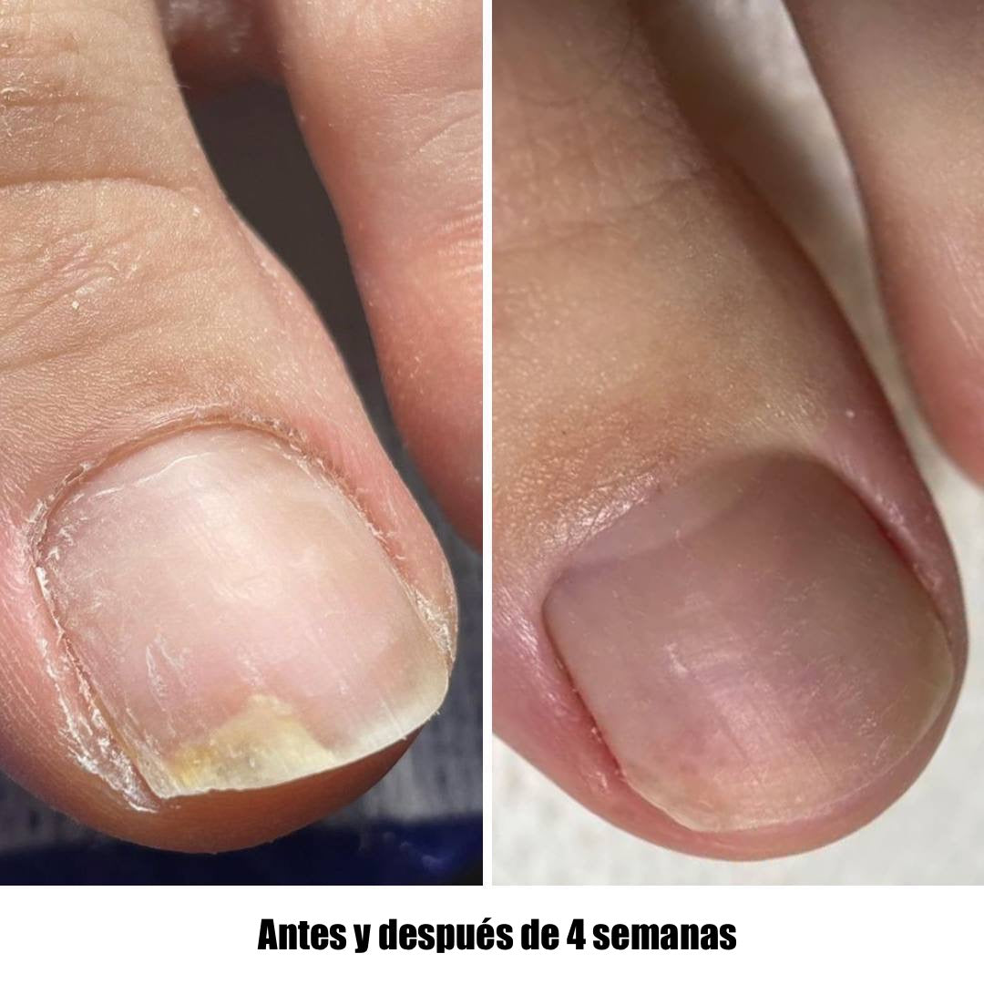 NAILSOFTHEDAY ONISTOP – Regenerating Oil, 15 ml